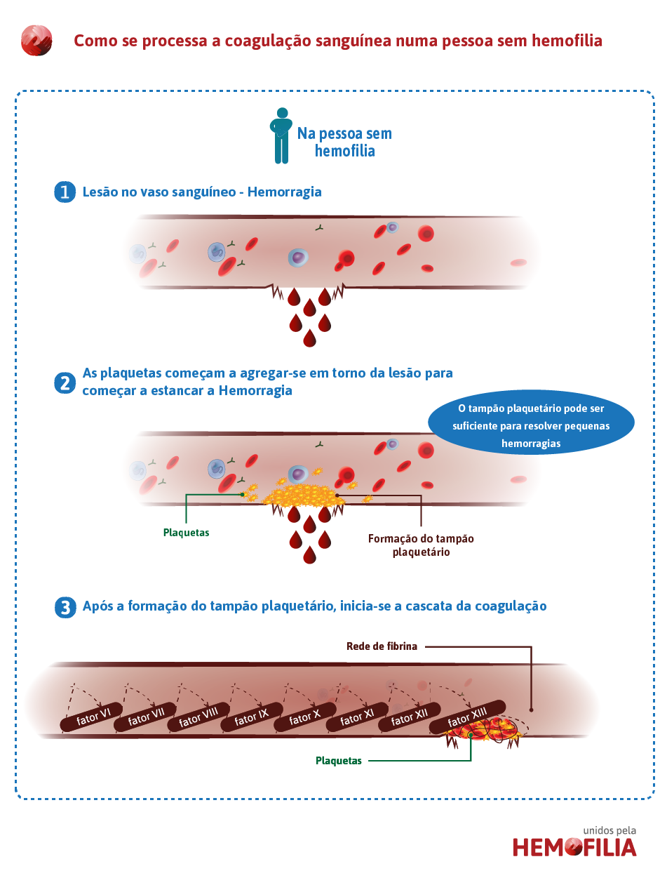 Como se processa a coagulacao num individuo sem hemofilia